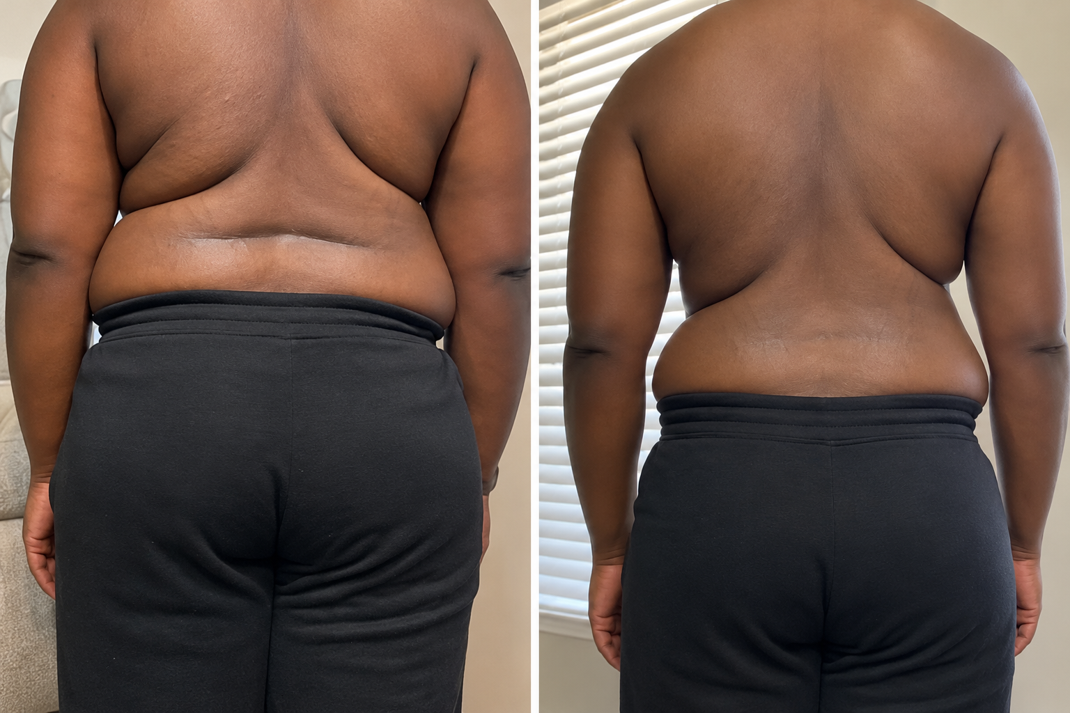 A coaching client's back, photographed before and after training with Jeremiah